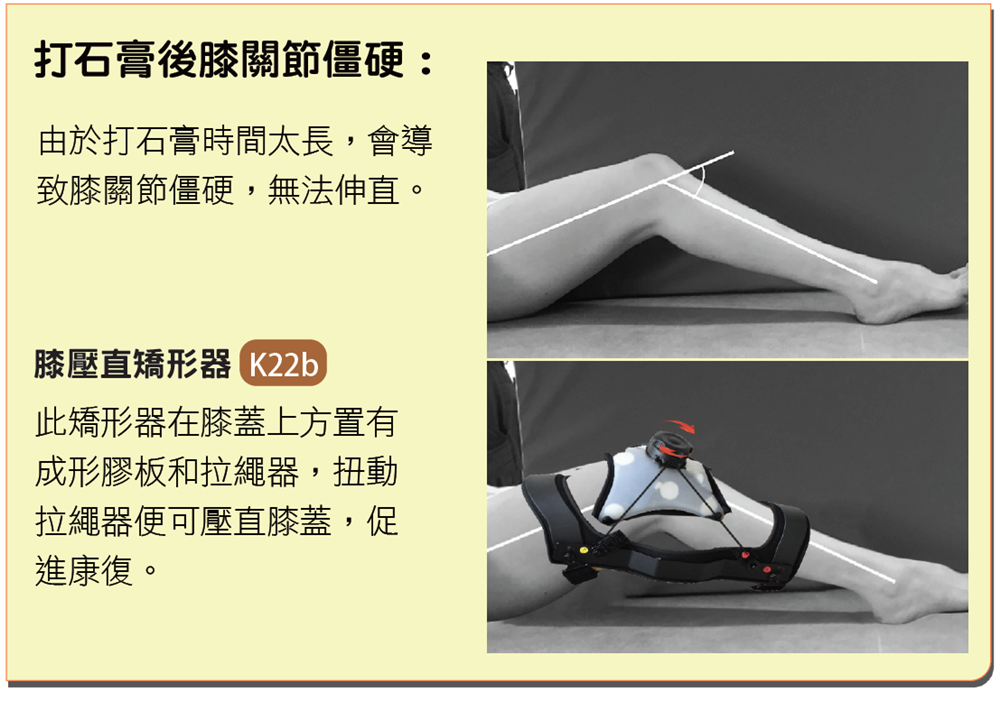 長腿固定步行靴